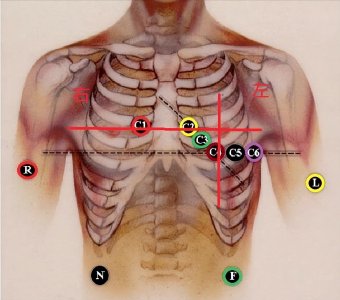 ​心电图导联位置图解-十字定位法，教你十秒牢记心电图操作